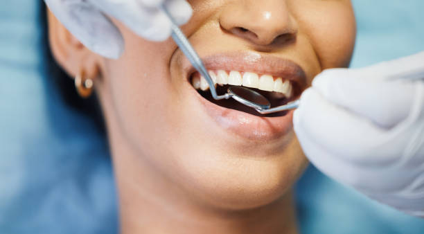Best Emergency Dentist for Lost Fillings or Crowns in Owings Mills, MD